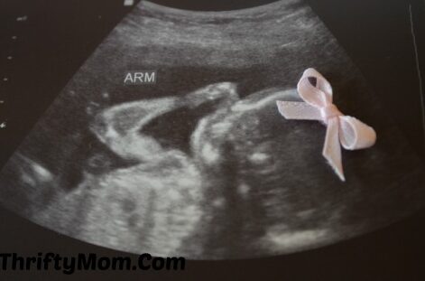 How to Reveal the Baby's Gender Using a Sonogram| The Dating Divas